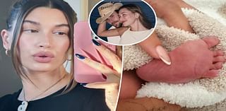 Hailey Bieber posts unfiltered selfie 4 weeks after welcoming son Jack Blues with Justin