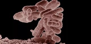 St. Louis County health officials confirm 69 cases of E. coli, expand investigation to 4 events