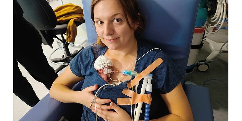 Tiny 'little warrior' baby who weighed just 11oz at birth finally comes home after 18 months in hospital