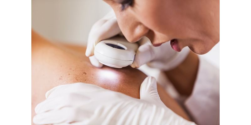 “Destination Healthy Skin” offering free skin cancer screenings in Morgantown