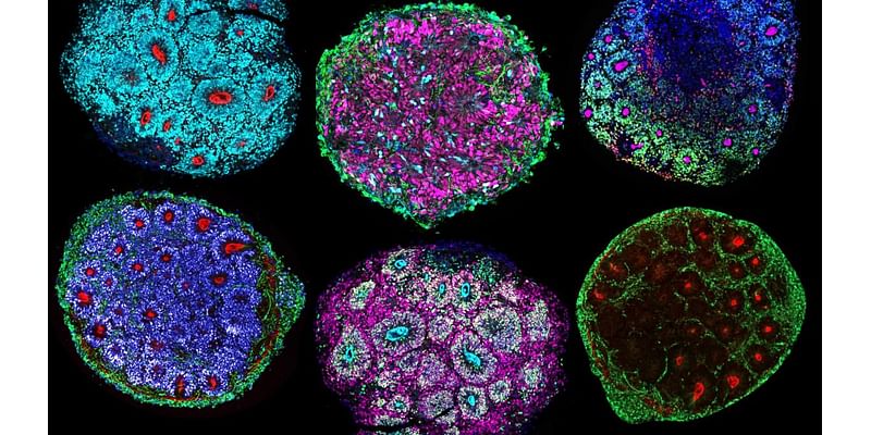 Scientists just grew the 1st-ever 'minibrains' from multiple people's cells