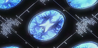 Teen brains aged faster during pandemic, researchers say