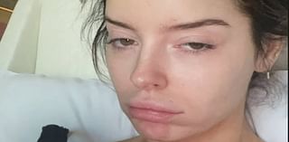 Maura Higgins goes makeup free in 'ruined' hungover selfie after wild night out in Las Vegas after it's denied she has quit I'm A Celebrity