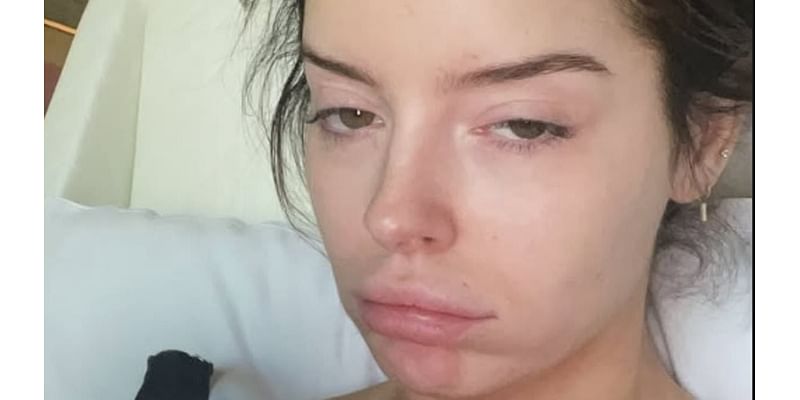 Maura Higgins goes makeup free in 'ruined' hungover selfie after wild night out in Las Vegas after it's denied she has quit I'm A Celebrity