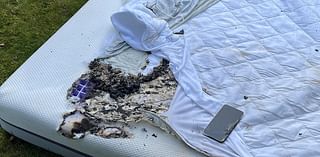 Horror as teen is set ablaze after common household item bought on Amazon exploded