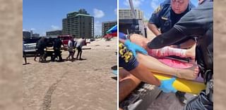 2 people bitten by sharks during Fourth of July celebrations Texas’ South Padre Island