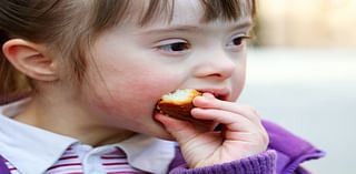 How Nutrition Can Help With Down Syndrome: An Expert's View