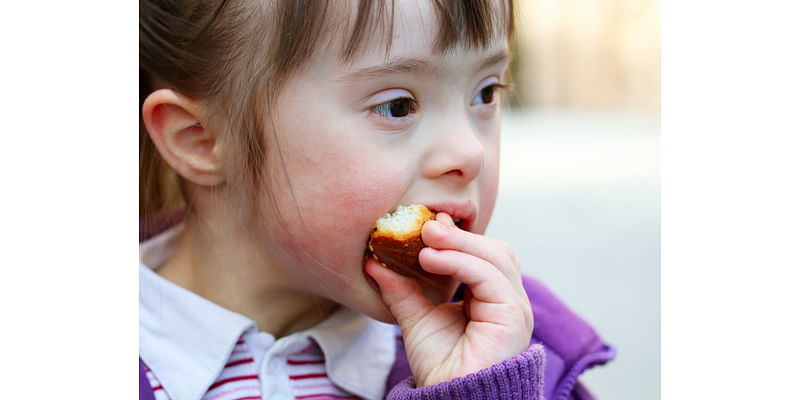 How Nutrition Can Help With Down Syndrome: An Expert's View