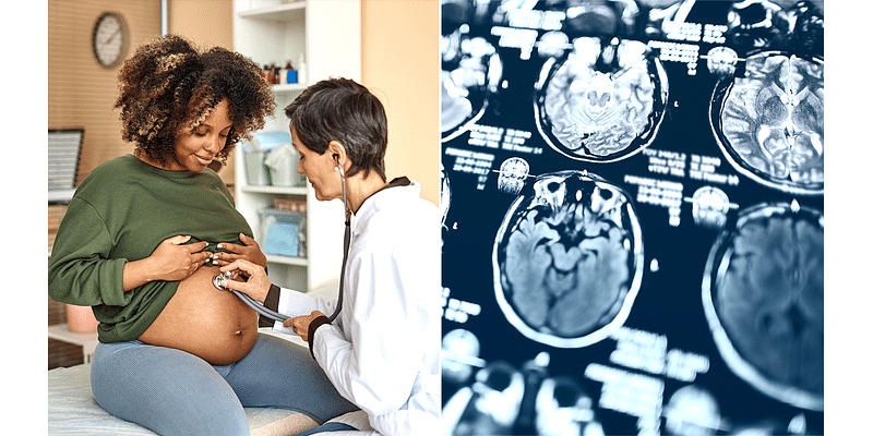 During pregnancy, a woman's brain experiences 'profound changes,' new study finds