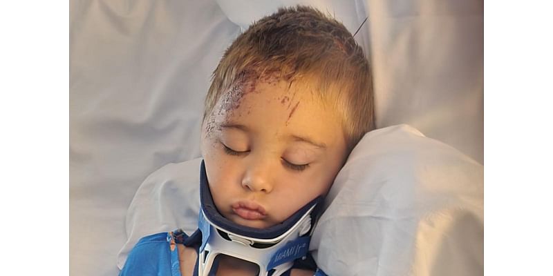 A Field Trip Ended in Skull Fractures for Wisc. Boy. Now He's Home and Healing: 'Blessed,' Says Mom (Exclusive)