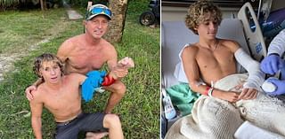 Teen surfer survives shark attack in Brevard County: 'Could have been so much worse'