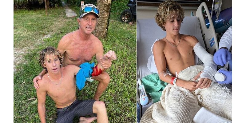 Teen surfer survives shark attack in Brevard County: 'Could have been so much worse'