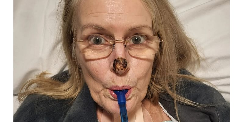 I was hours from death as killer bacteria ate away at my face until BAKING SODA made me 'rise like a cake'