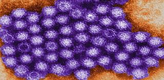 What is norovirus, as cases surge with new Kawasaki variant?