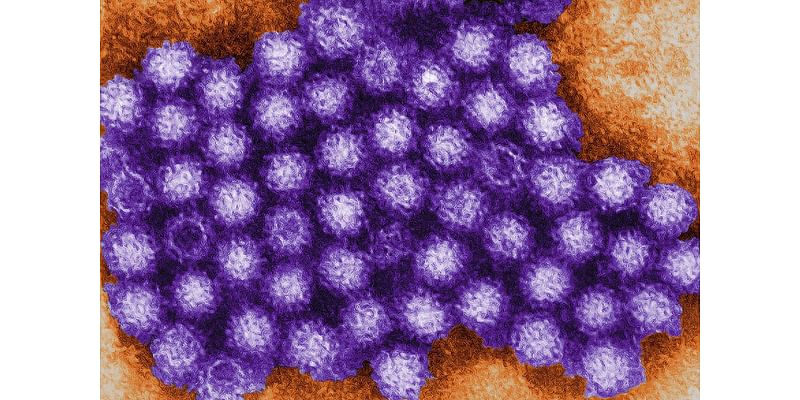 What is norovirus, as cases surge with new Kawasaki variant?