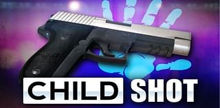 9-year-old shot in leg; Mobile Police say