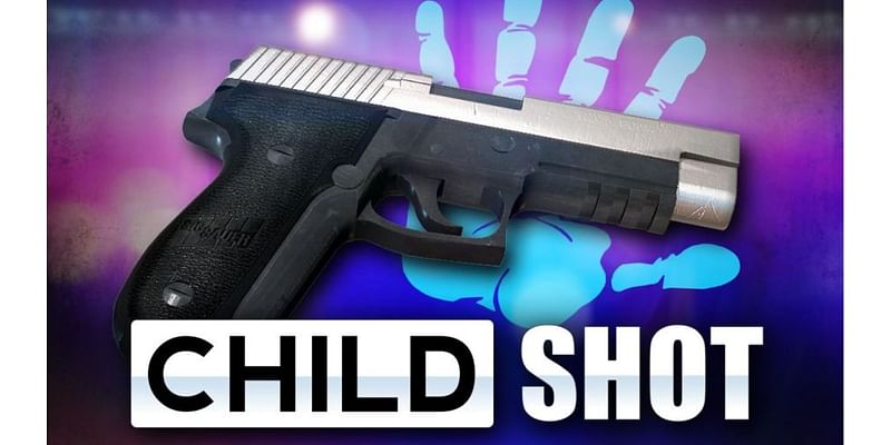 9-year-old shot in leg; Mobile Police say