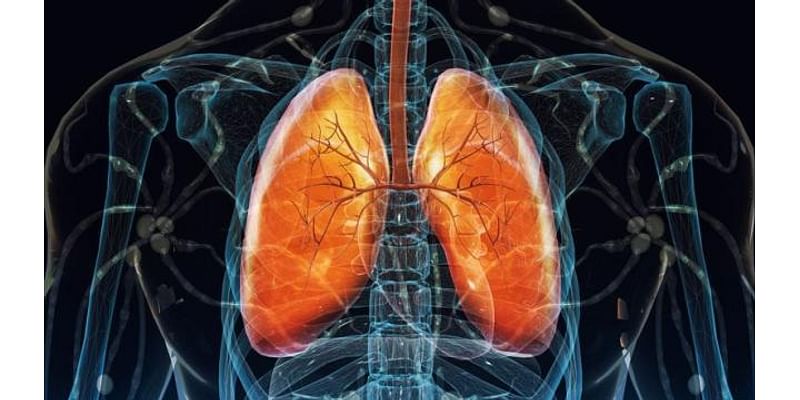 Thousands of Georgians are diagnosed with lung cancer each year, and you don’t have to be a smoker