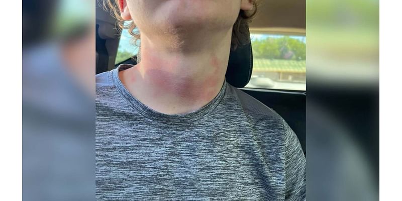 Liberty Hill ISD student with special needs had red hand marks around his neck, mother says