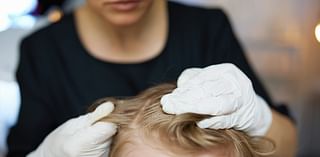 Super Lice Are Here—And They're Stronger Than Ever