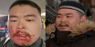 Police search for man who sucker-punched sushi chef outside NYC subway