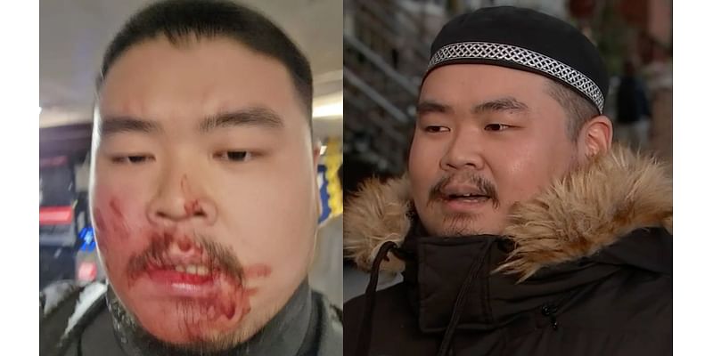 Police search for man who sucker-punched sushi chef outside NYC subway