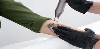 Tattoo trauma: Edinburgh residents rue their tattoos