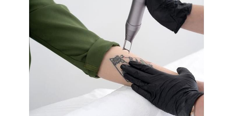 Tattoo trauma: Edinburgh residents rue their tattoos