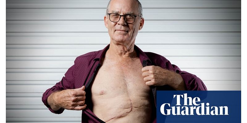 ‘I couldn’t believe it’: routine GP checkup reveals 2kg tumour growing in Brisbane man’s liver