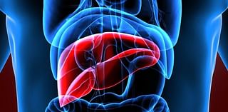 AI Helps Spot Liver Disease Early