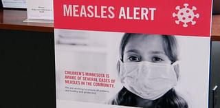 Vaccine hesitancy concerns physicians amid Minnesota measles outbreak