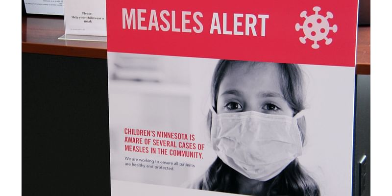 Vaccine hesitancy concerns physicians amid Minnesota measles outbreak