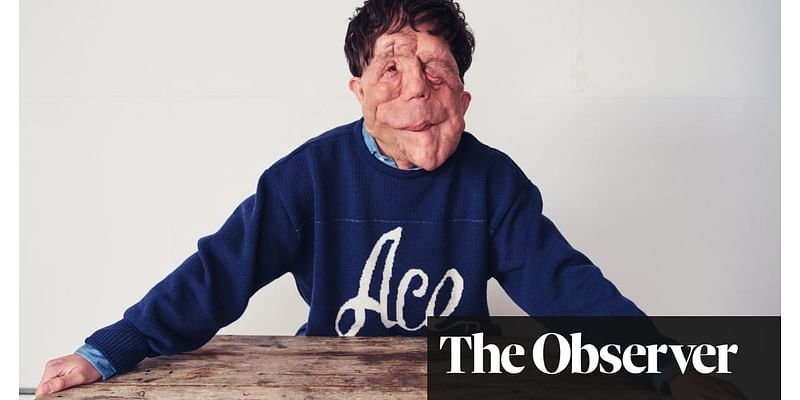 ‘My disability is the least interesting thing about me’: Actor Adam Pearson on fame, film and his sibling rivalry