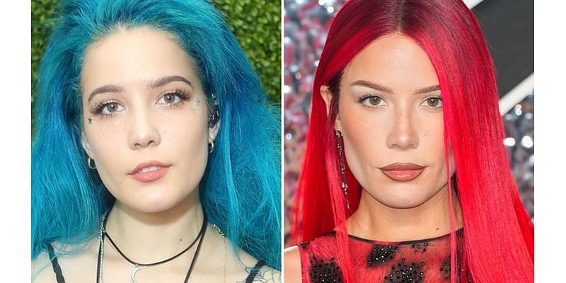 Halsey -- Good Genes or Good Docs?!