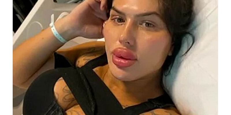 I almost died following botched surgery in Turkey - my breasts were leaking green gunk: Influencer who has spent more than £500,000 on plastic surgery to become 'ultimate bimbo' says 'my life was on t