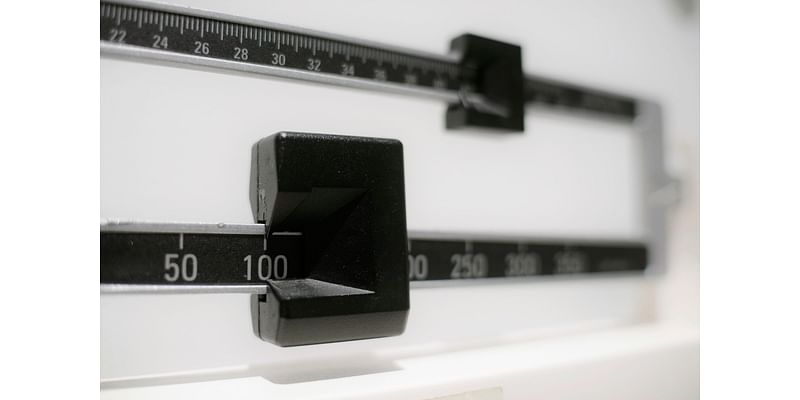 Report shows 23 states have reached 35% obesity rate; here’s how Texas fares