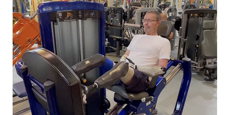 'Bionic MP' Craig Mackinlay who lost his limbs to sepsis in quadruple amputation hits the gym in video marking one year since his life-changing operation