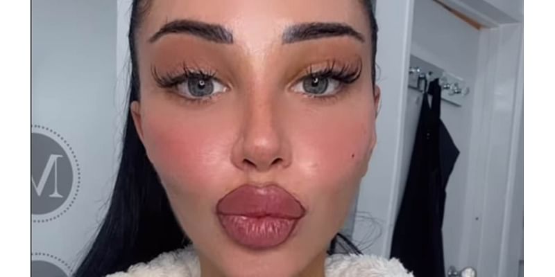 Tulisa reveals shocking results of swollen TATTOOED lips as she treats herself to cosmetic procedure ahead of I'm A Celeb stint