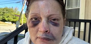 Woman who was left bruised and bloodied after being beaten up by home invaders reveals how loyal pup saved her life