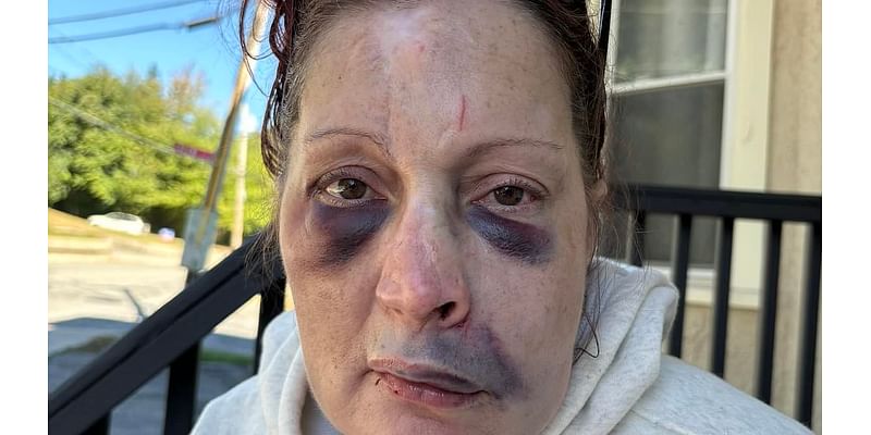 Woman who was left bruised and bloodied after being beaten up by home invaders reveals how loyal pup saved her life