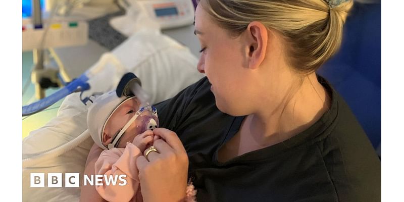 Sterilised mother's 'miracle baby' survives breathing scare