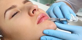 Terrifying life-long risks of lip filler - chemicals may seep into the bloodstream fuelling CANCER, claim experts