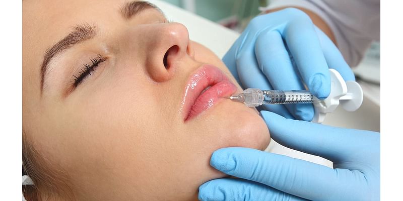 Terrifying life-long risks of lip filler - chemicals may seep into the bloodstream fuelling CANCER, claim experts